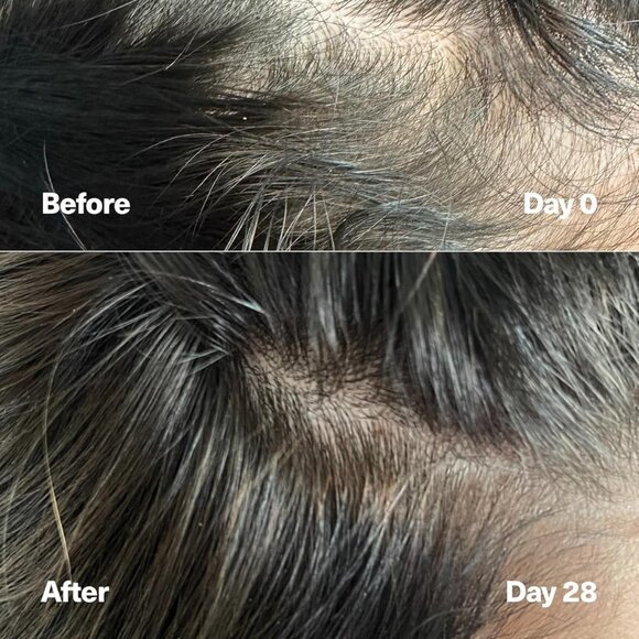 SickScience PowerCycle Scalp Treatment Serum – Hair Growth & Strength Booster - Picture 7 of 13